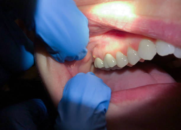 Best Emergency Treatment for Toothache in Highfill, AR