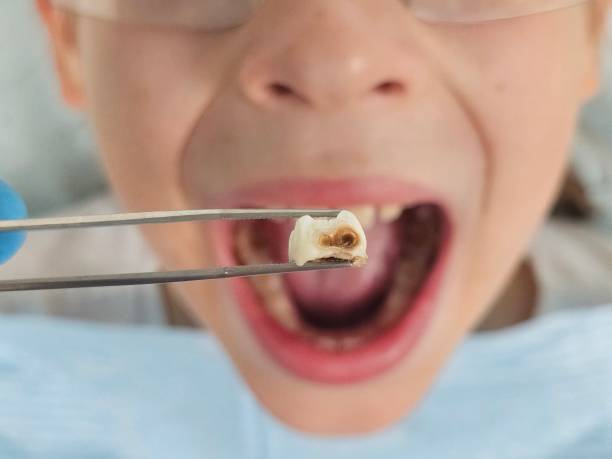 Best After-Hours Emergency Dentist in Highfill, AR